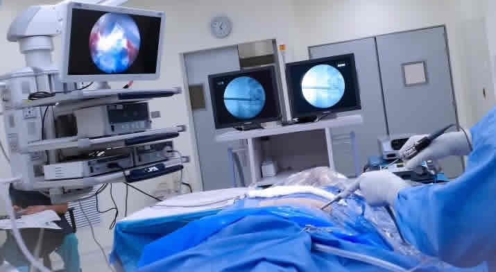 Cirugía Endoscópica de Columna Vertebral