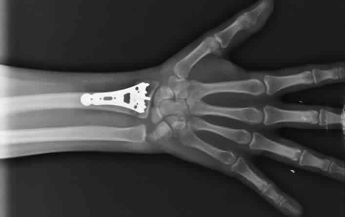 Otros servicios de Ortopedia y Traumatología