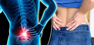 Lumbalgia y Ciática